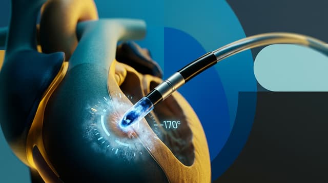 Adagio Medical secures FDA nod to expand clinical trial for next-gen VT ablation system