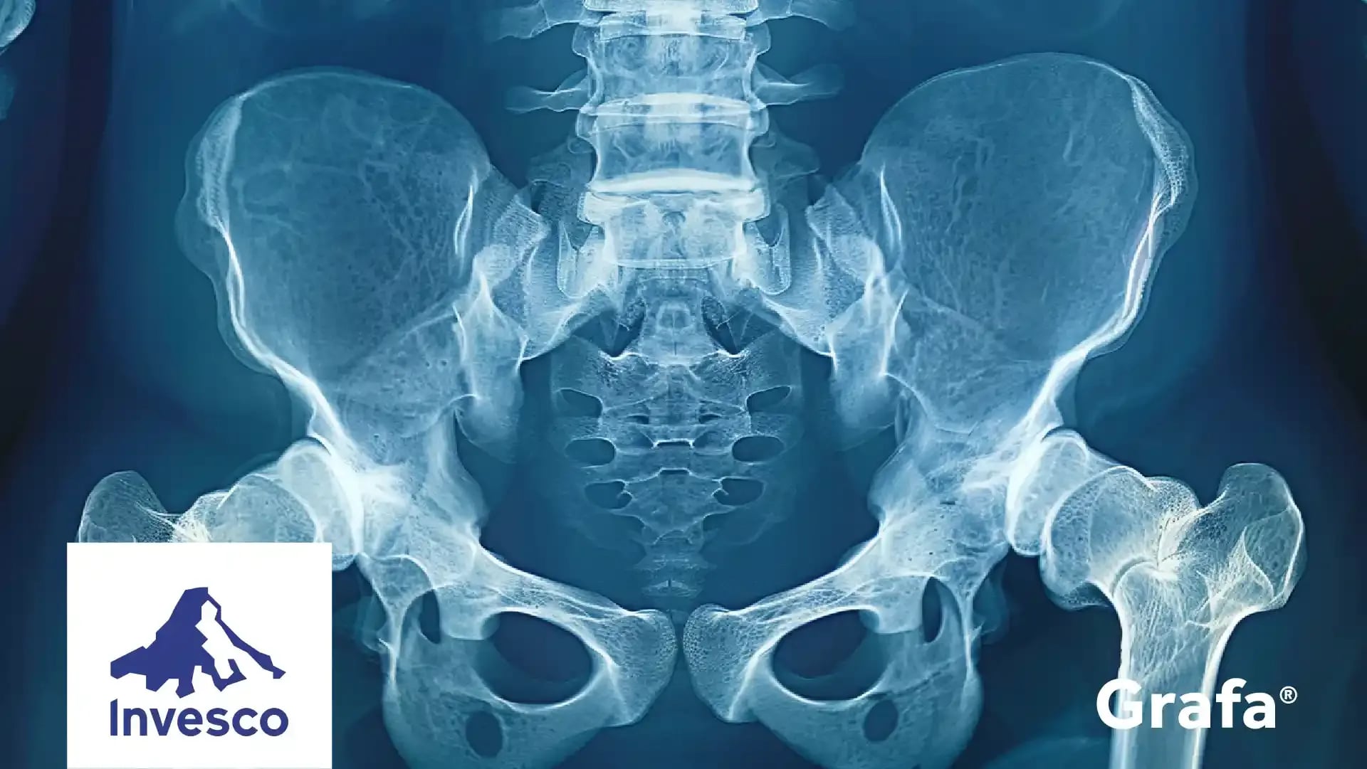 Invesco S&P SmallCap Health Care ETF primary media